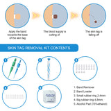Band Skin Tag Wart and Mole Remover Pen Kit Contents